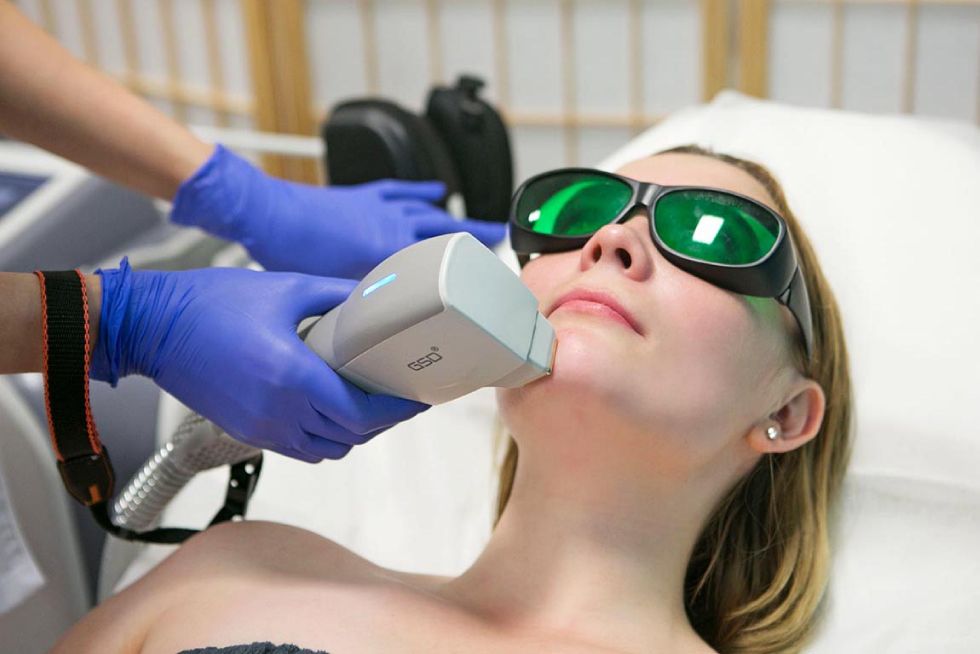 Luiza Różycka, zdjęcia zabiegów kosmetycznych epilacja laserowa